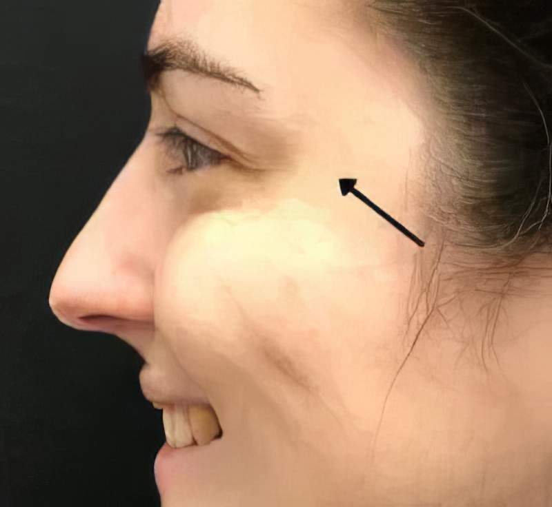 bxa-after-01Edit About the practice