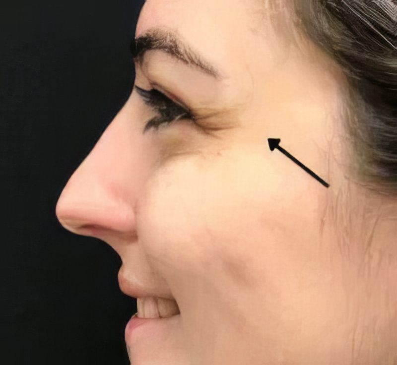 bxa-before-01Edit About the practice